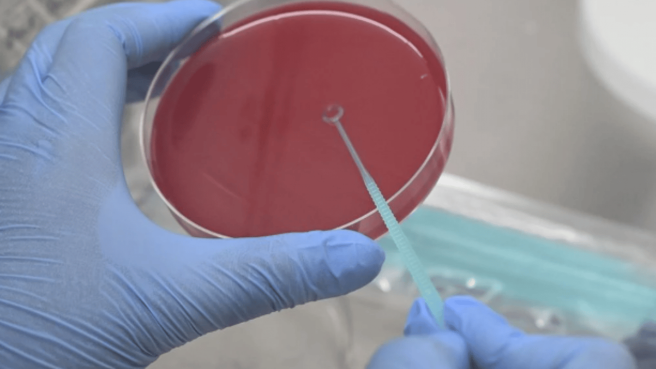 Foto - Uzmanından uyarı geldi! Vakalar artıyor! Yüksek bulaşıcılığı ve ciddi sonuçları var