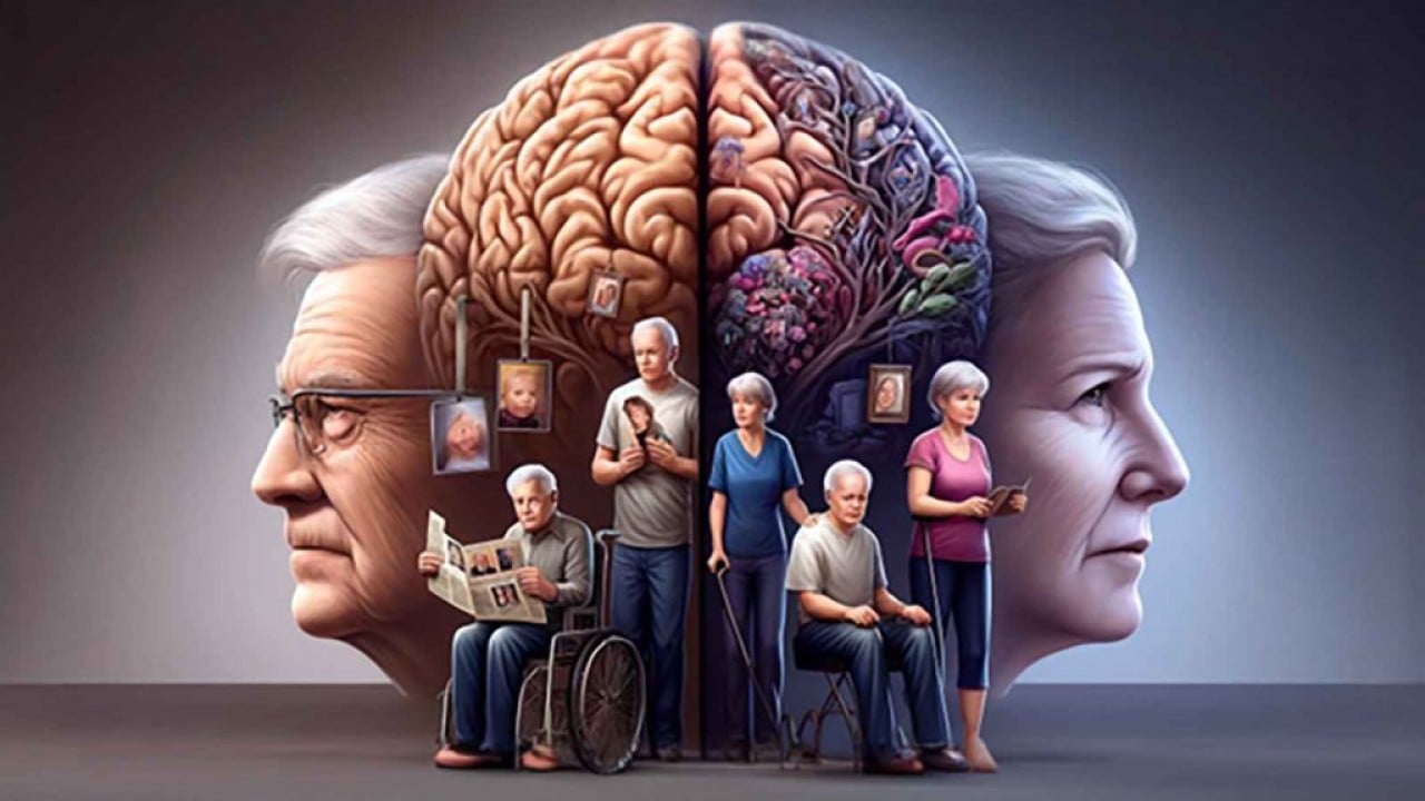 Foto - Uzmanından uyarı: Yaşlılarda kötü ağız sağlığı Alzheimer riskini 4 kat artırıyor