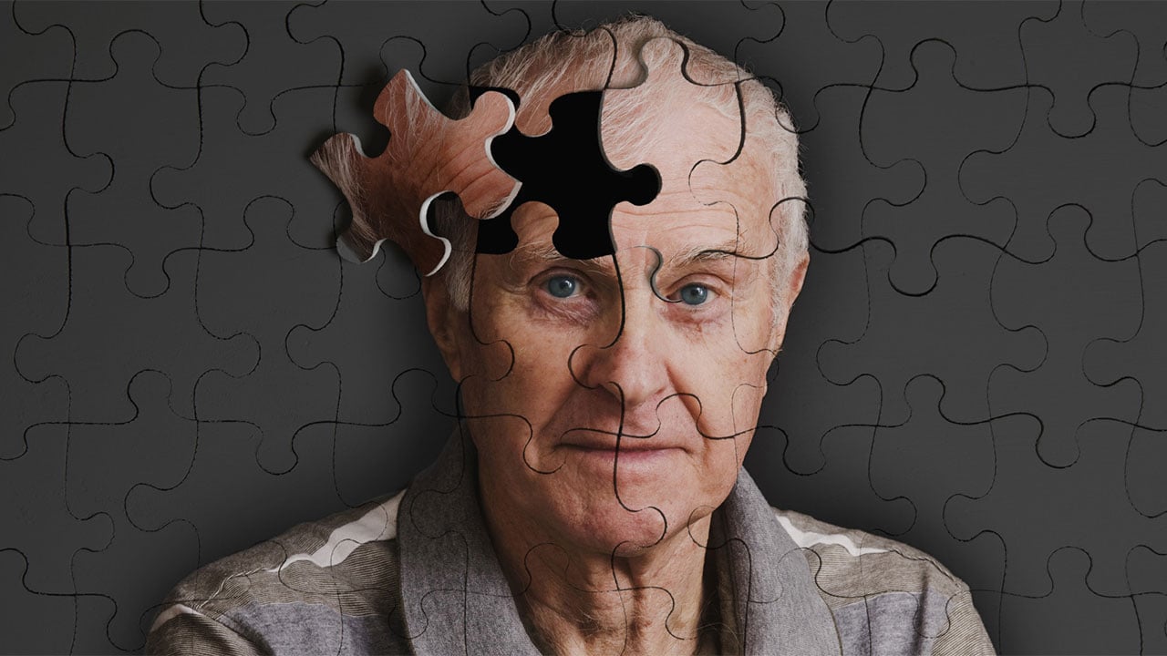 Foto - Uzmanından uyarı: Yaşlılarda kötü ağız sağlığı Alzheimer riskini 4 kat artırıyor