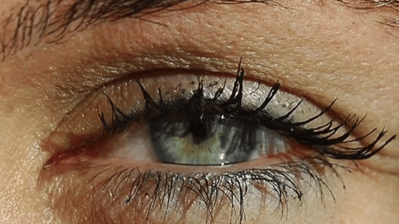 Foto - Uzmanlar açıkladı: Bu hastalık sessizce ilerliyor, teşhis gecikirse kör ediyor