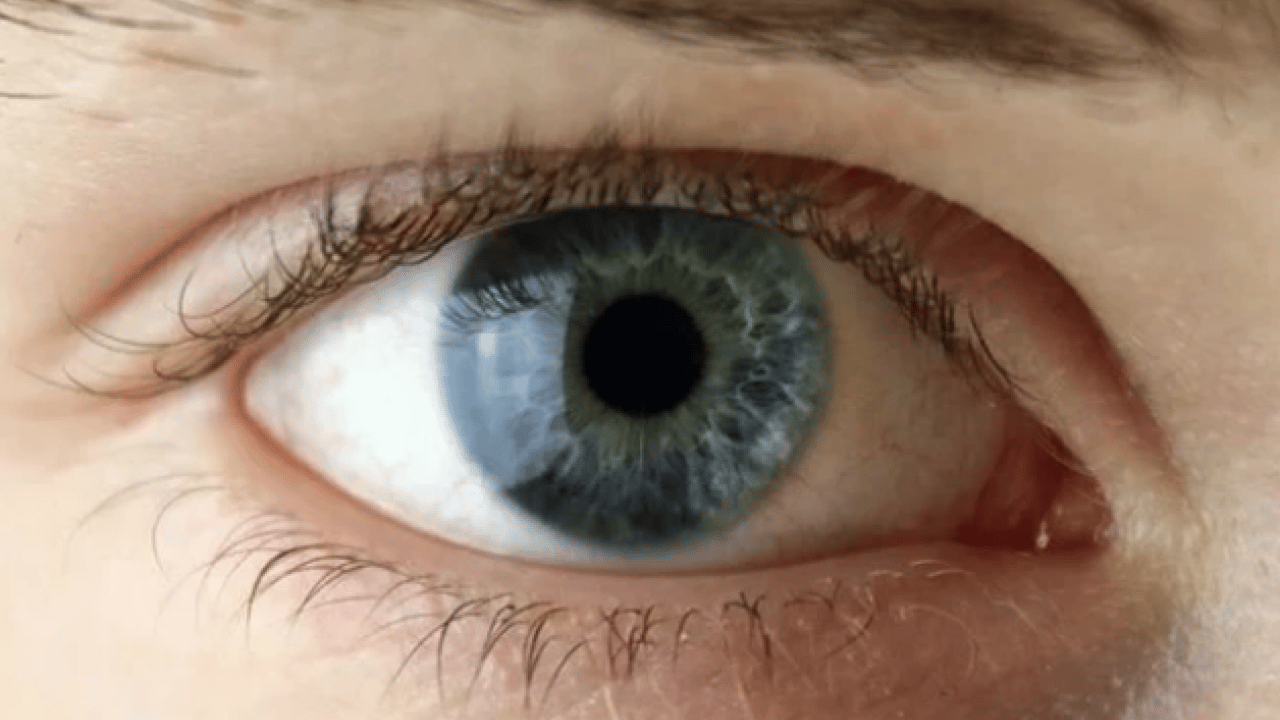 Foto - Uzmanlar açıkladı: Bu hastalık sessizce ilerliyor, teşhis gecikirse kör ediyor