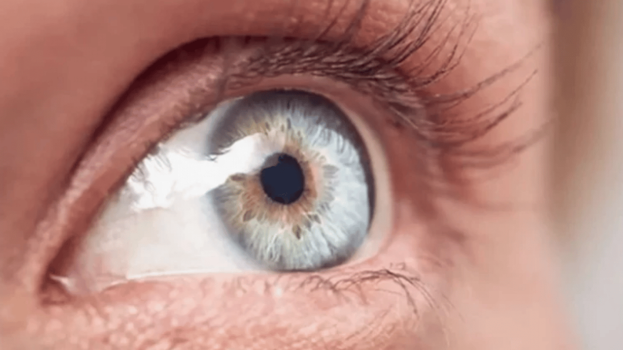 Foto - Uzmanlar açıkladı: Bu hastalık sessizce ilerliyor, teşhis gecikirse kör ediyor