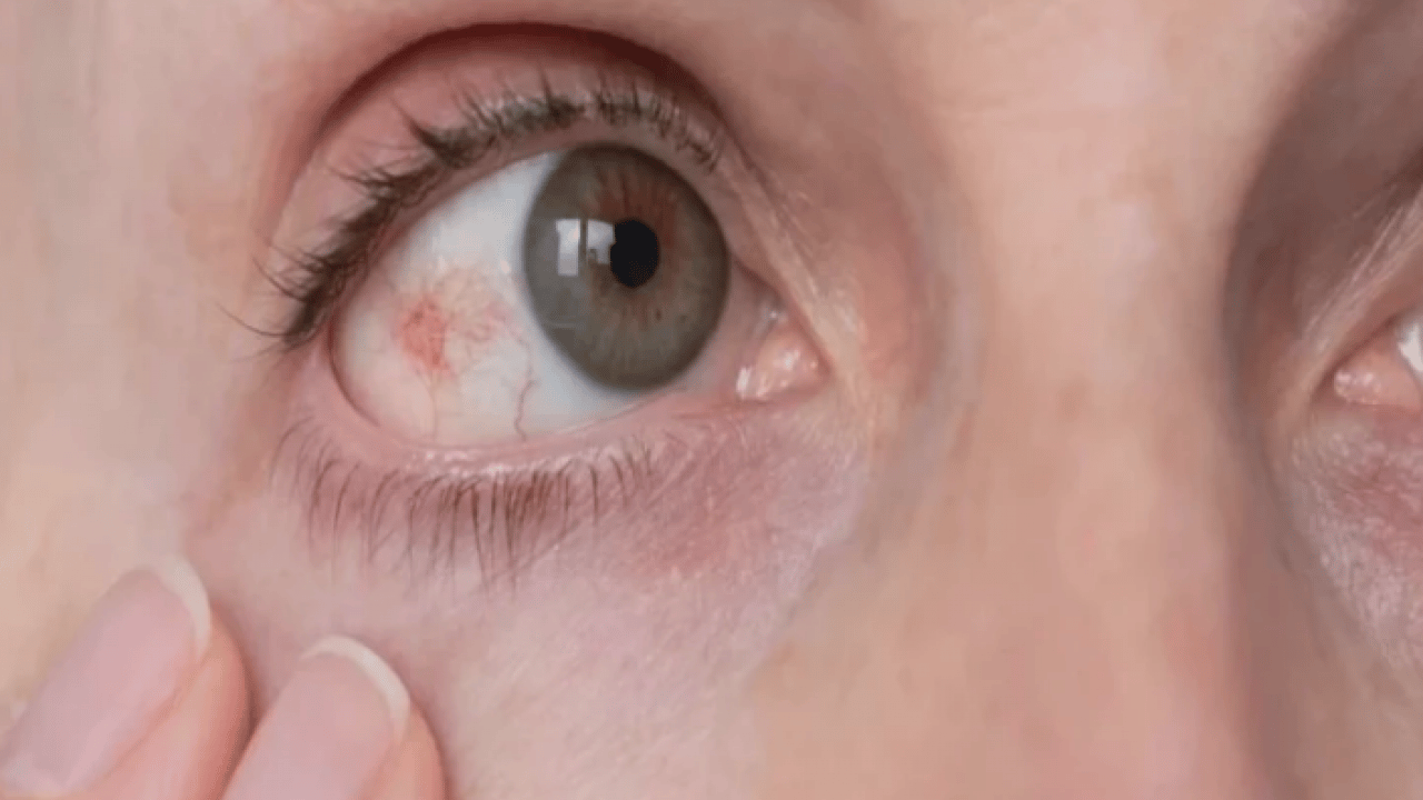 Foto - Uzmanlar açıkladı: Bu hastalık sessizce ilerliyor, teşhis gecikirse kör ediyor