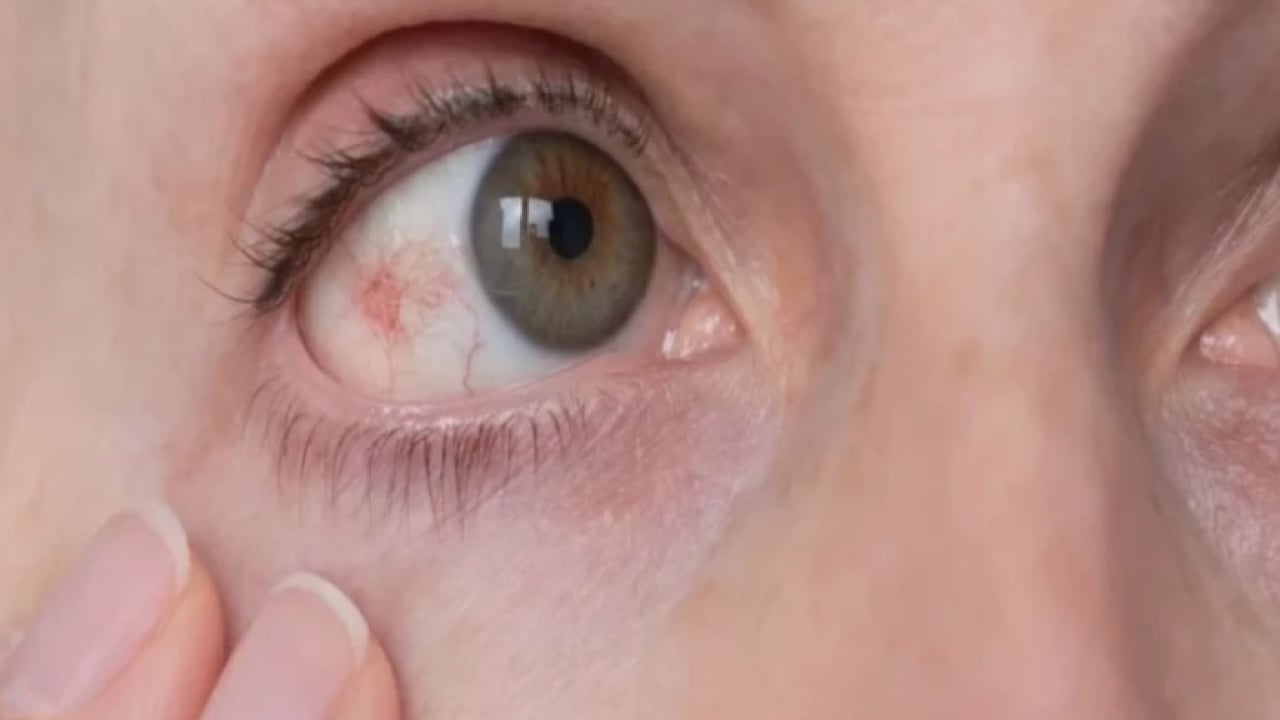 Foto - Uzmanlar açıkladı: Bu hastalık sessizce ilerliyor, teşhis gecikirse kör ediyor