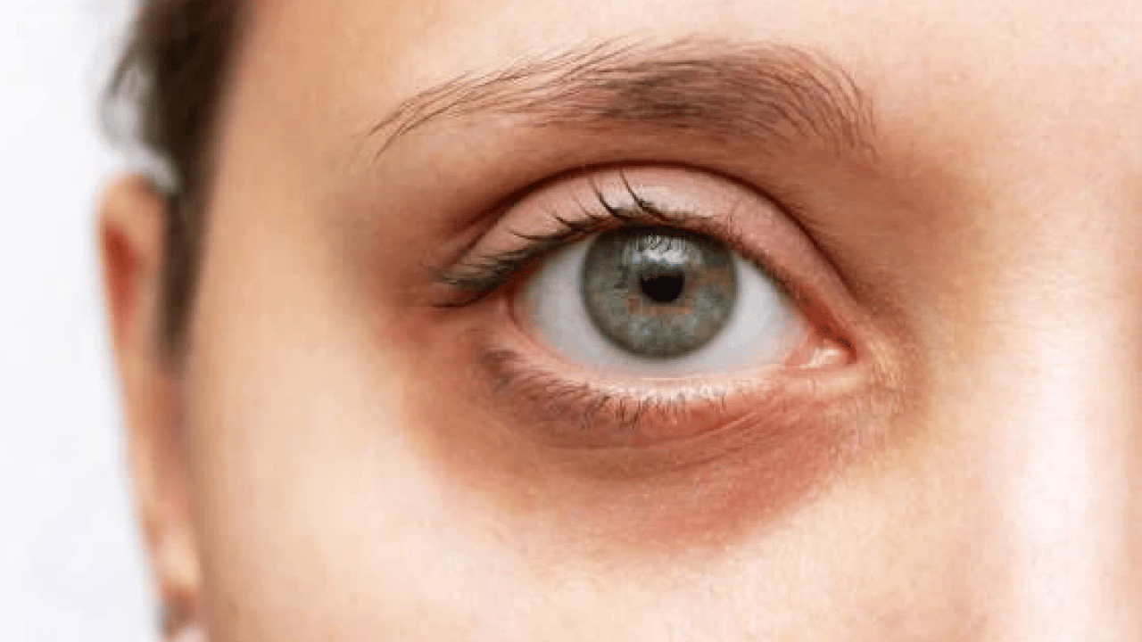 Foto - Uzmanlar açıkladı! Katarakt nasıl tedavi edilir?