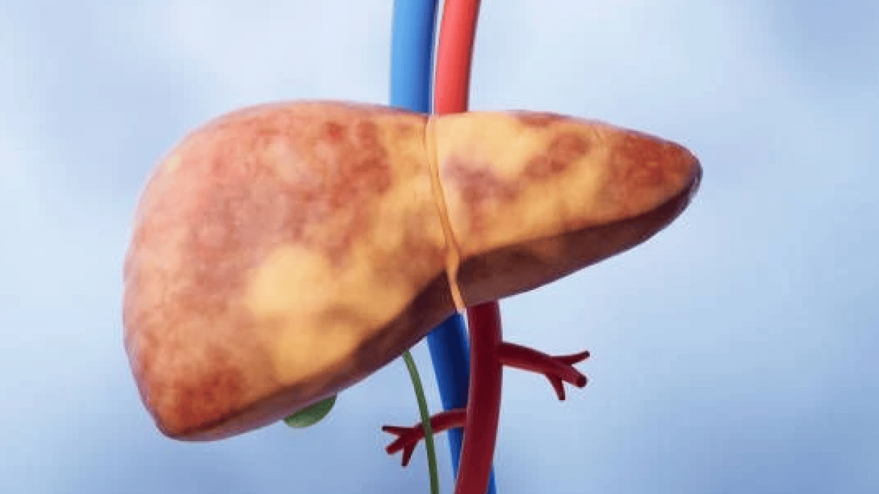 Foto - Uzmanlar merak edilen soruları cevapladı! Sürekli halsizlik neden olur ve nasıl geçer