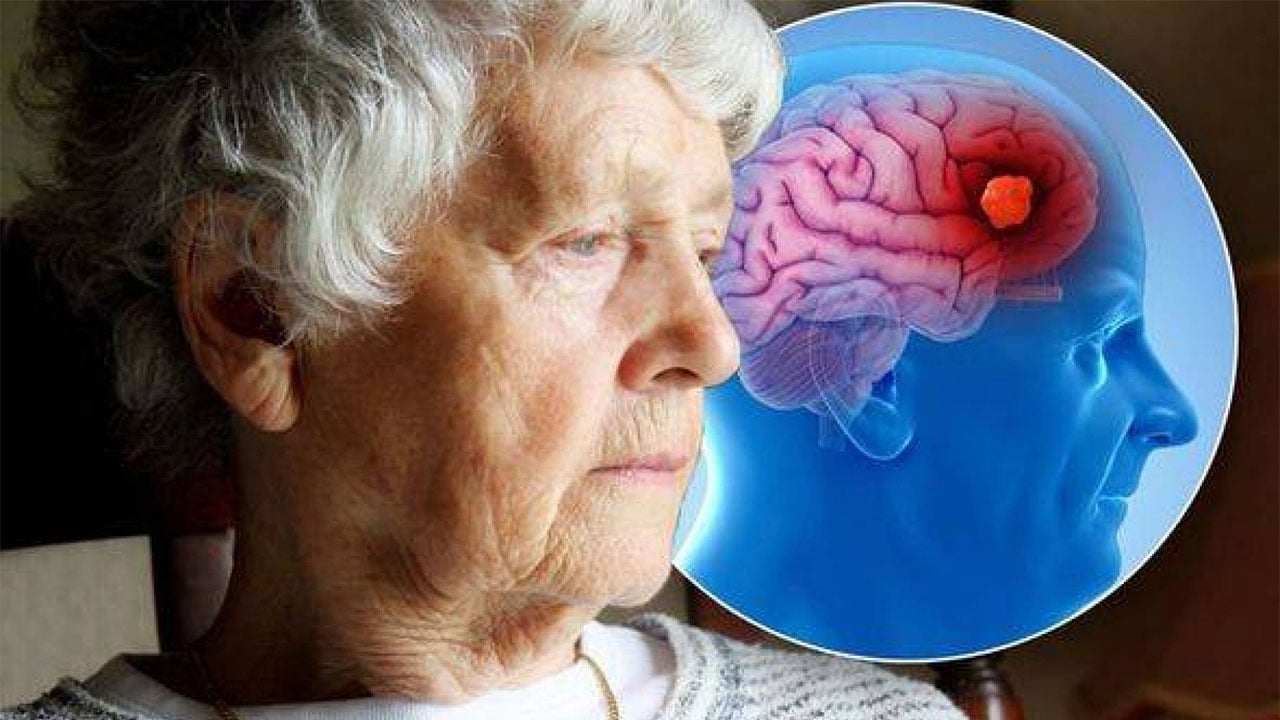 Foto - Uzmanlar tek tek sıraladı: İşte bunama riskini bıçak gibi kesen 11 besin