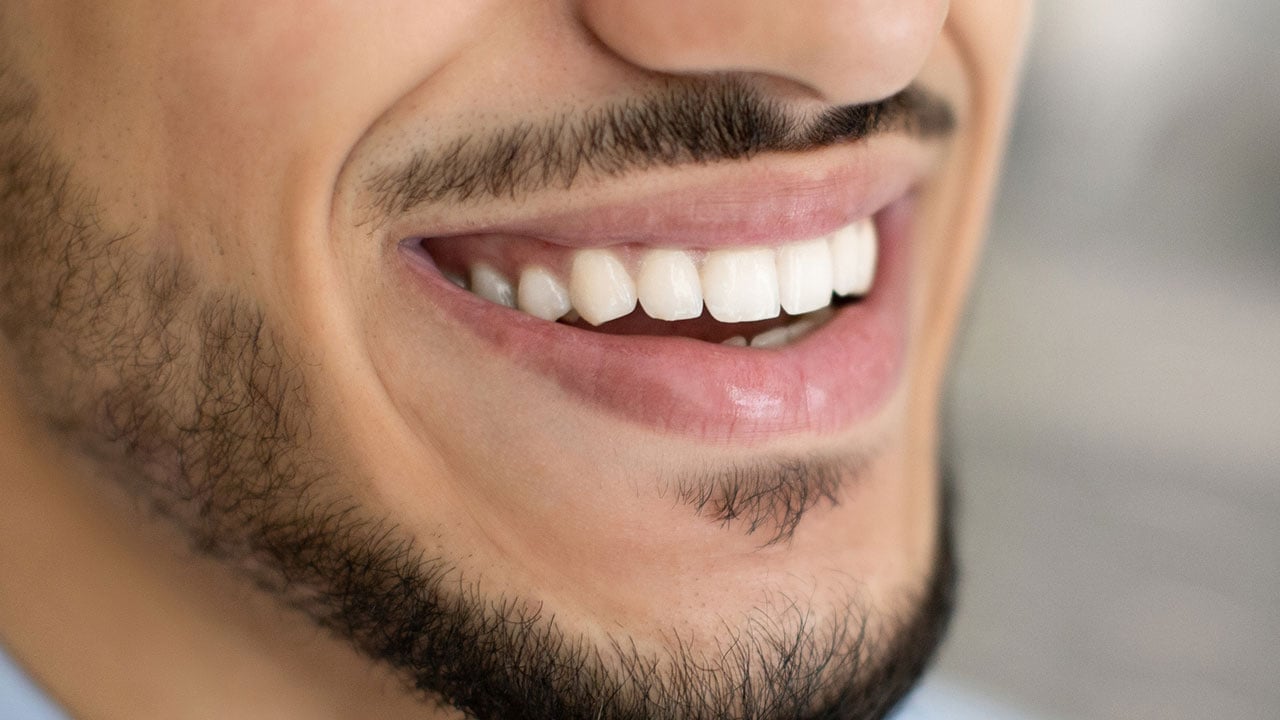 Foto - Uzmanlar üstüne basa basa uyarıyor! Bembeyaz dişlerle gelen kapkapara gelecek