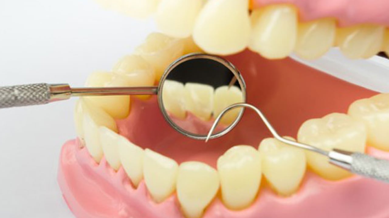 Foto - Uzmanlardan önemli uyarı: Kanal tedavisi ihmali kistlere yol açabilir