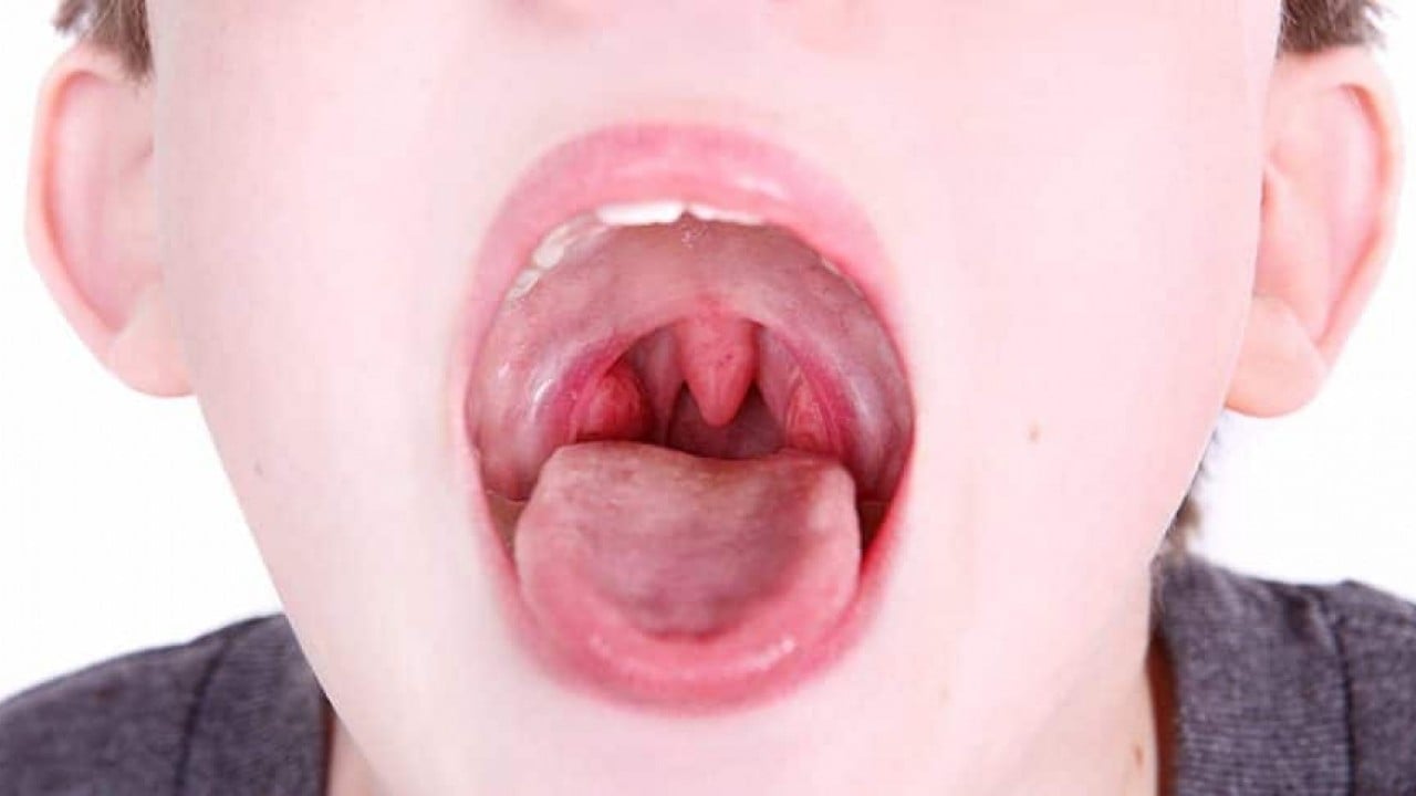 Foto - Uzmanlardan uyarı! Çocuklarda o hastalıların sebebi geniz eti olabilir