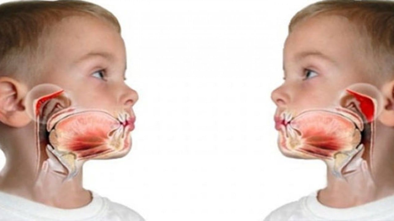 Foto - Uzmanlardan uyarı! Çocuklarda o hastalıların sebebi geniz eti olabilir