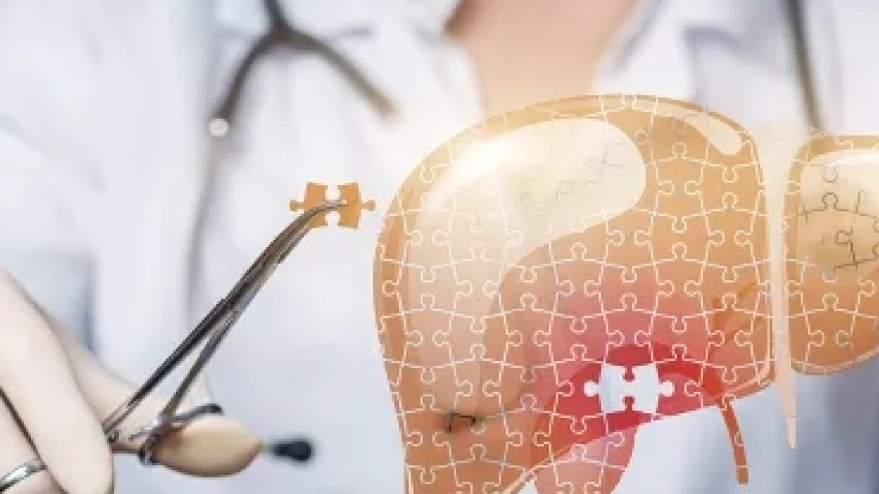 Foto - Uzun süren ve açıklanamayan cilt değişiklikleri karaciğer hastalıklarının habercisi olabilir! Uzman isim uyardı