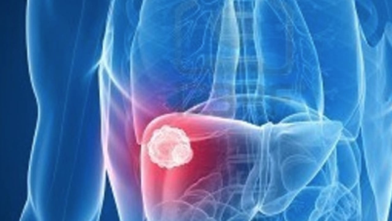 Foto - Uzun süren ve açıklanamayan cilt değişiklikleri karaciğer hastalıklarının habercisi olabilir! Uzman isim uyardı