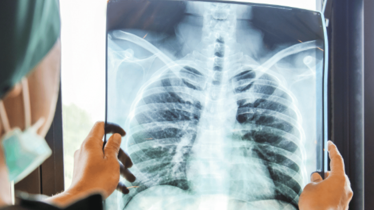 Foto - Vakalarda patlama yaşanıyor: ''Beyaz veba'' tehlike saçıyor!