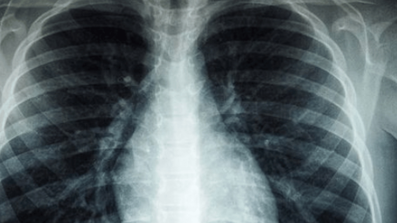 Foto - Vakalarda patlama yaşanıyor: ''Beyaz veba'' tehlike saçıyor!