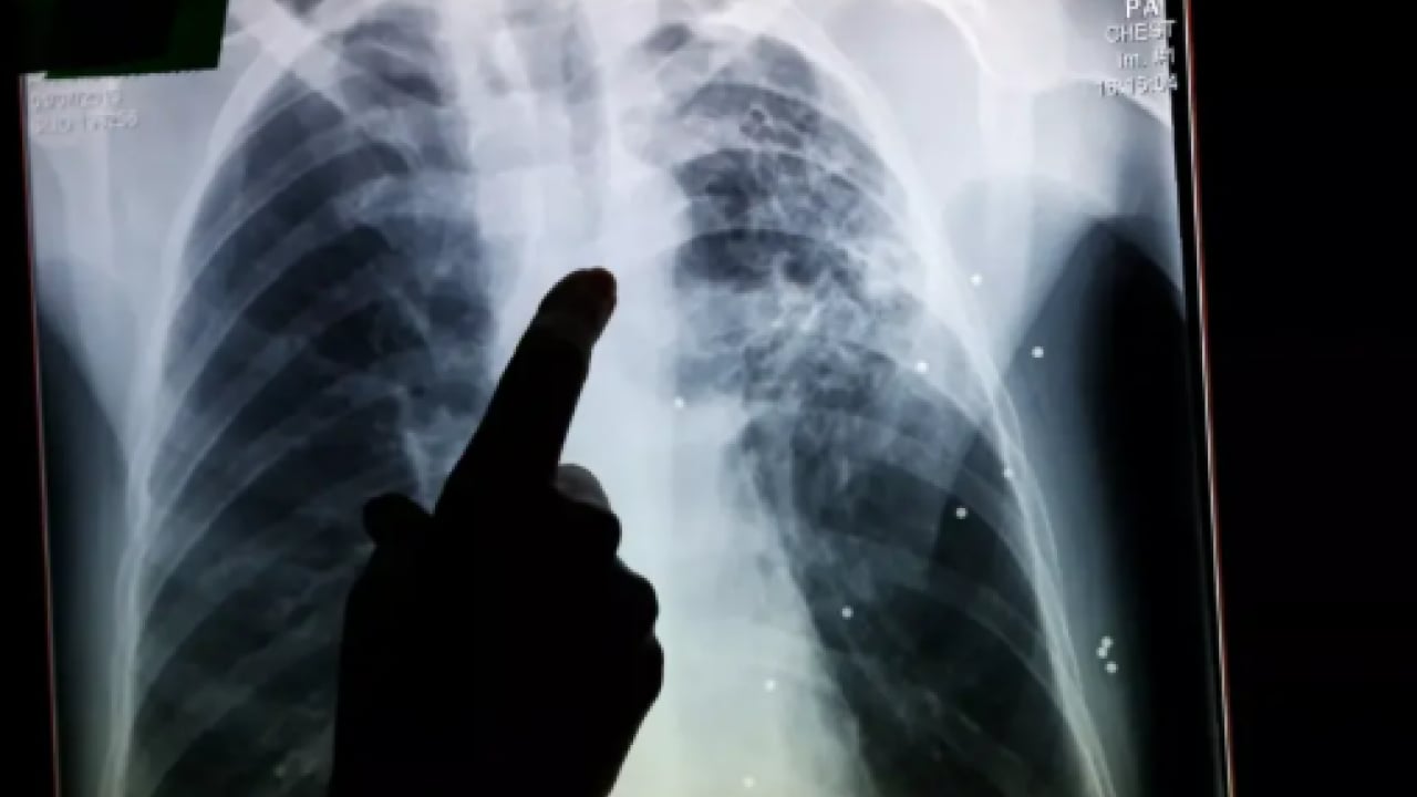 Foto - Vakalarda patlama yaşanıyor: ''Beyaz veba'' tehlike saçıyor!