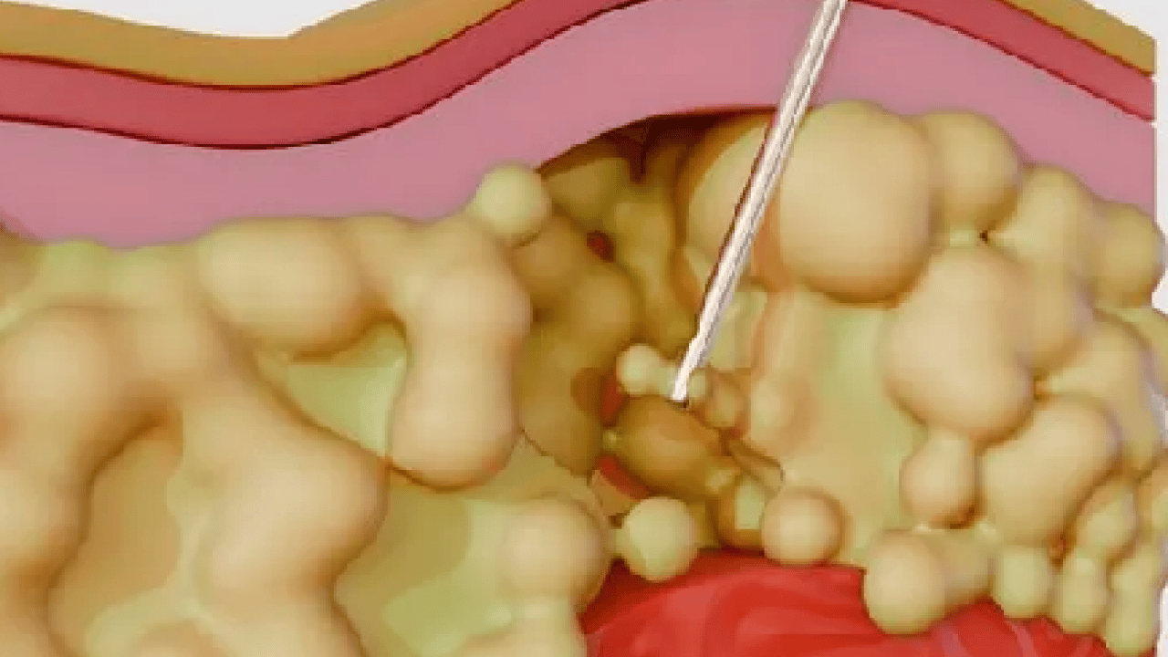 Adeta sessiz salgın: Veremediğiniz kilolar aslında vücudunuzun yardım çığlığı! Buna kulak vermezseniz işte o zaman…