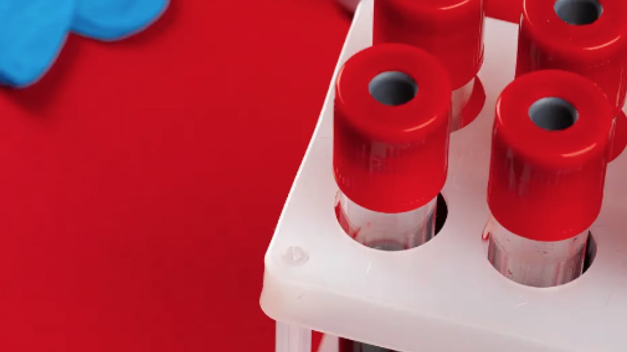 Foto - Viral hastalıklara... Enfeksiyon onlara uğramıyor: En sağlıklı kan grubu