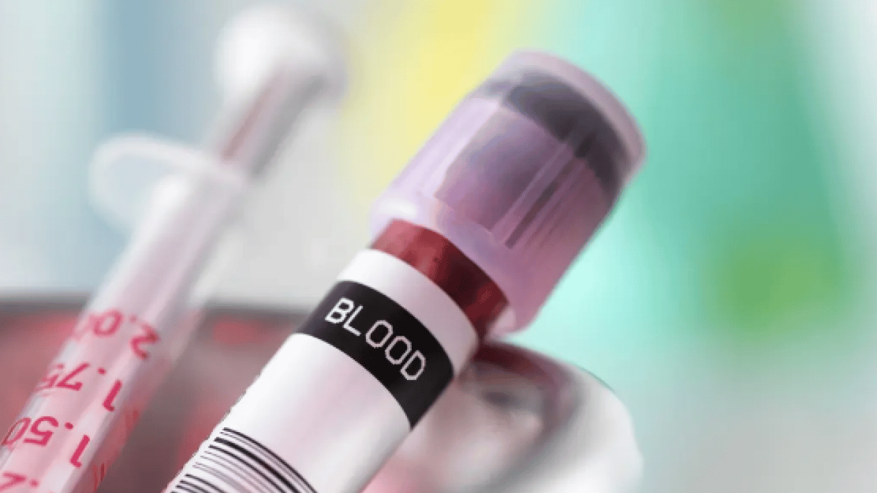 Foto - Viral hastalıklara... Enfeksiyon onlara uğramıyor: En sağlıklı kan grubu