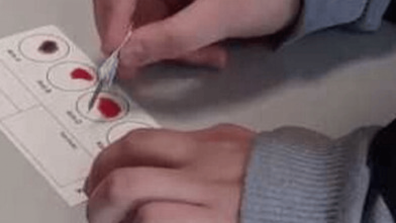 Foto - Viral hastalıklara... Enfeksiyon onlara uğramıyor: En sağlıklı kan grubu