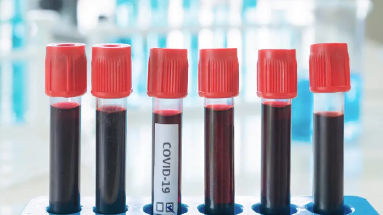 Foto - Viral hastalıklara... Enfeksiyon onlara uğramıyor: En sağlıklı kan grubu