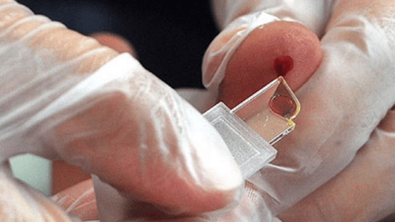 Foto - Viral hastalıklara... Enfeksiyon onlara uğramıyor: En sağlıklı kan grubu