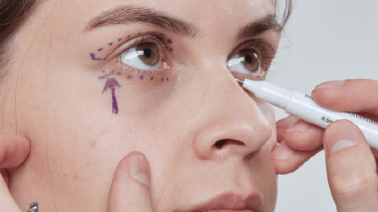 Foto - Vitrektomi ne işe yarar! Retina yırtıkları veya dekolmanı önemli...