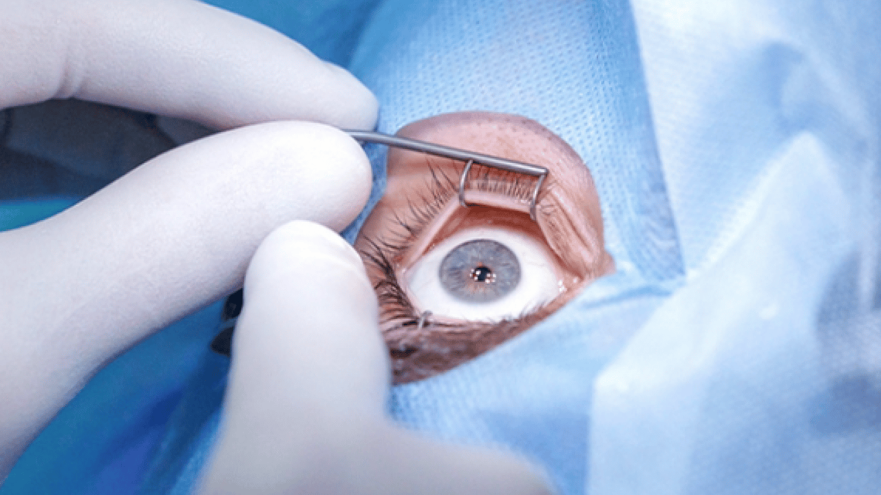 Foto - Vitrektomi ne işe yarar! Retina yırtıkları veya dekolmanı önemli...