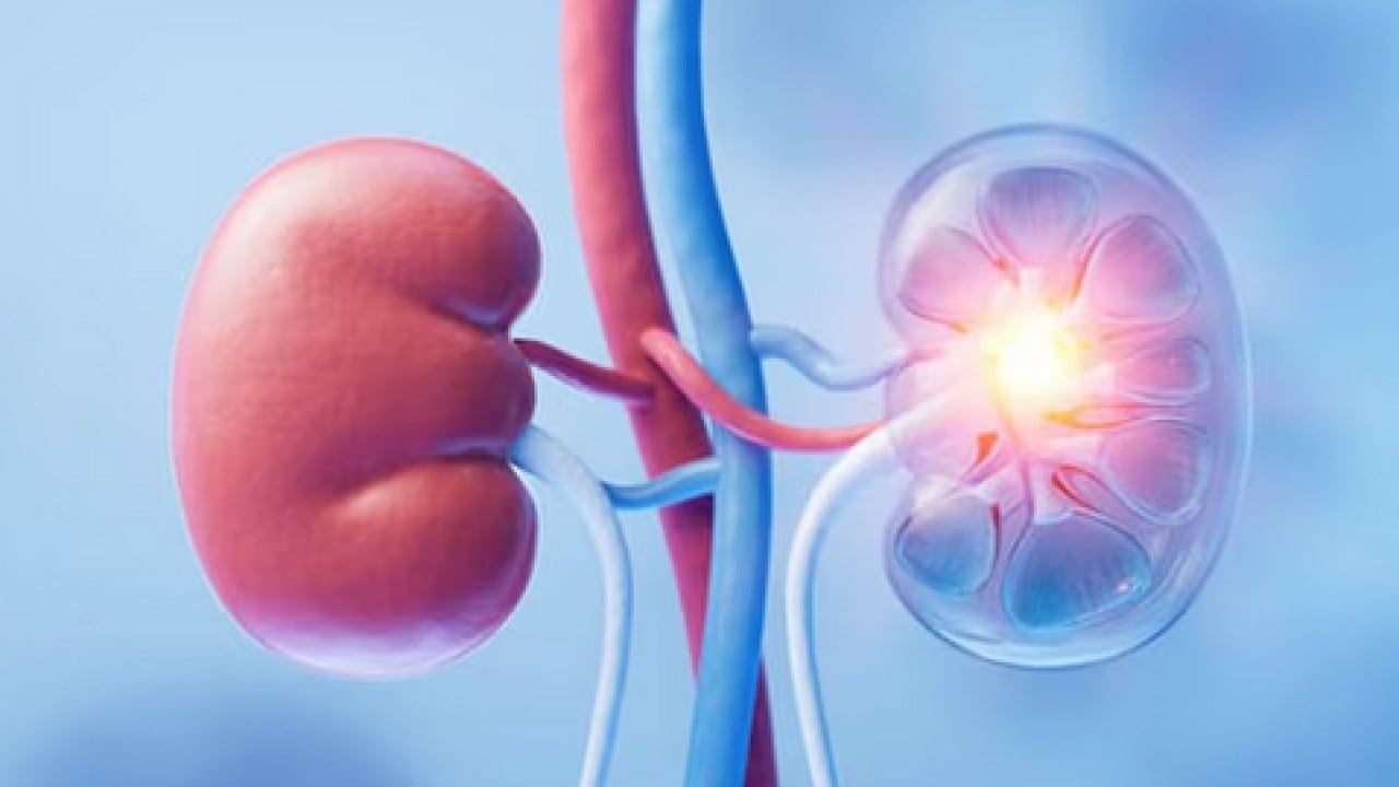 Foto - Vücudumuzu ilgilendiren şok gerçeğe dikkat! Erken müdahale edilmezse ciddi sonuçlara yol açıyor!