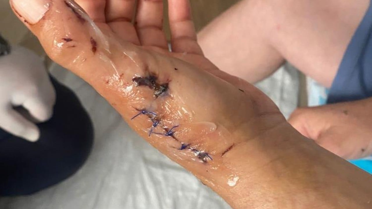Foto - Vücuduna 80 dikiş atıldı Köpeği dehşet saçan patron yan çizdi