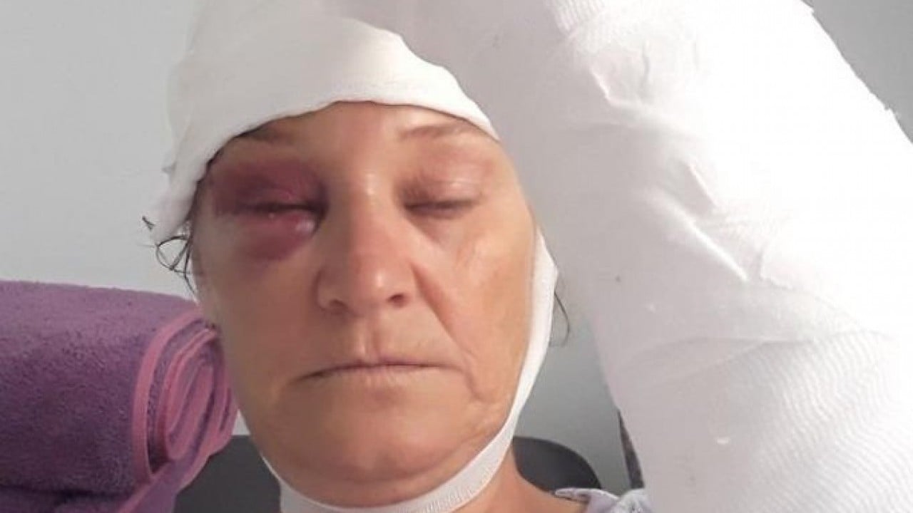 Foto - Vücuduna 80 dikiş atıldı Köpeği dehşet saçan patron yan çizdi