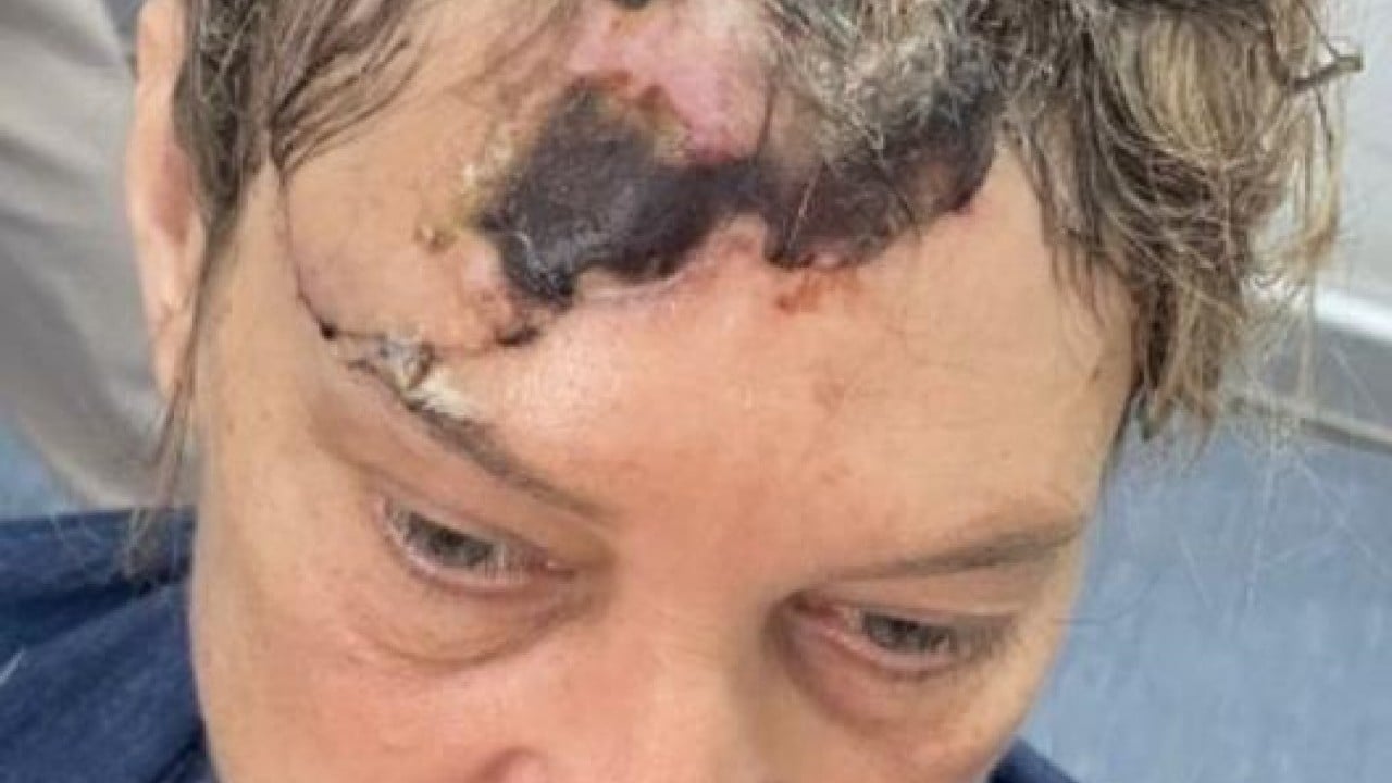 Foto - Vücuduna 80 dikiş atıldı Köpeği dehşet saçan patron yan çizdi