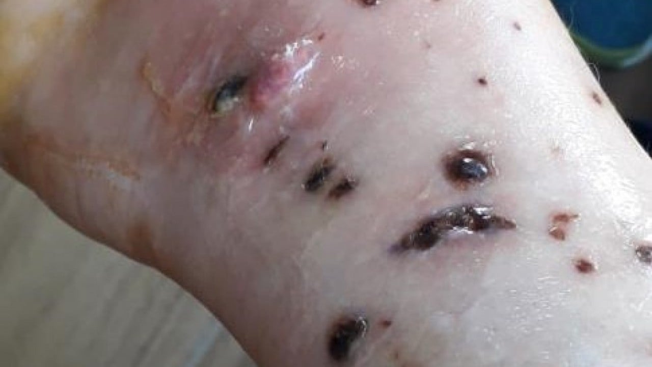 Foto - Vücuduna 80 dikiş atıldı Köpeği dehşet saçan patron yan çizdi