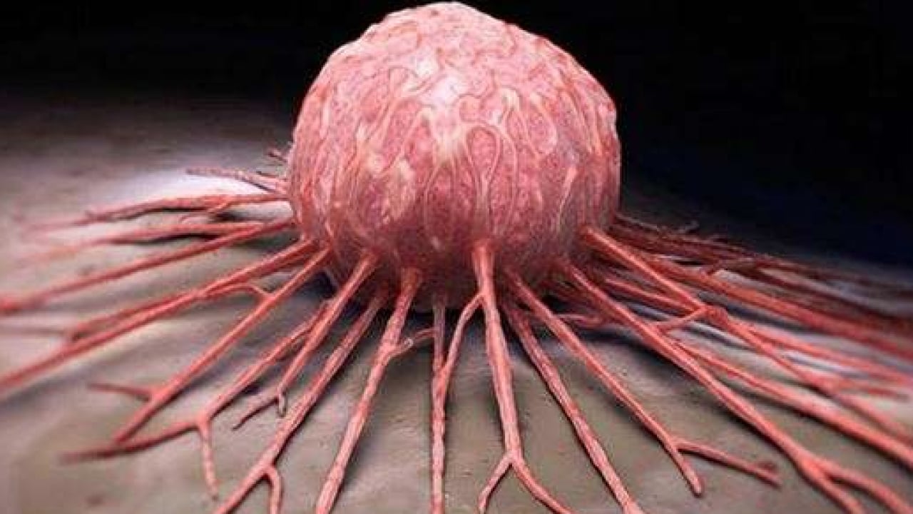 Foto - Vücutta büyük çöküş başlıyor ve... Teker teker terk ediyorlar: Çocuklarda belirti sinsi olabilir