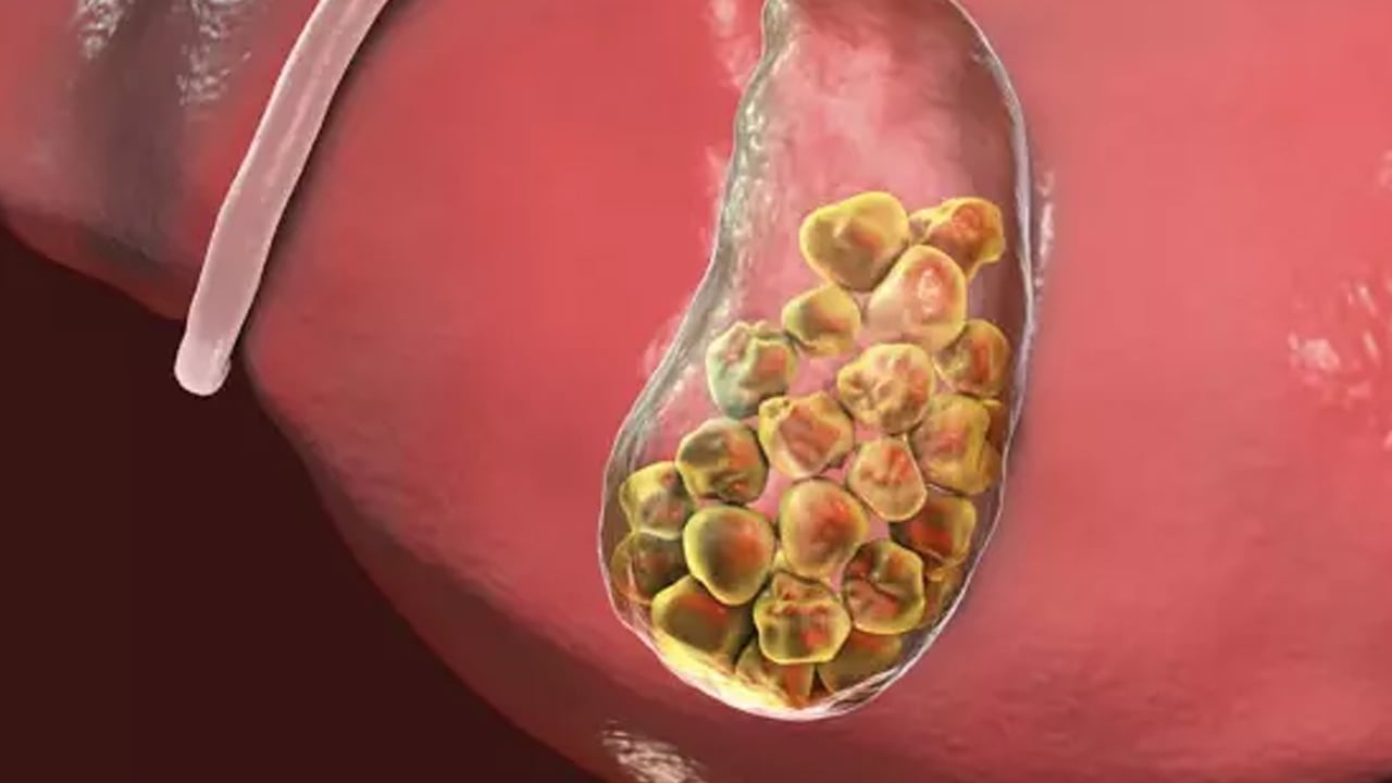 Foto - Vücuttaki iltihapları kurutuyor! Çayı içerseniz...