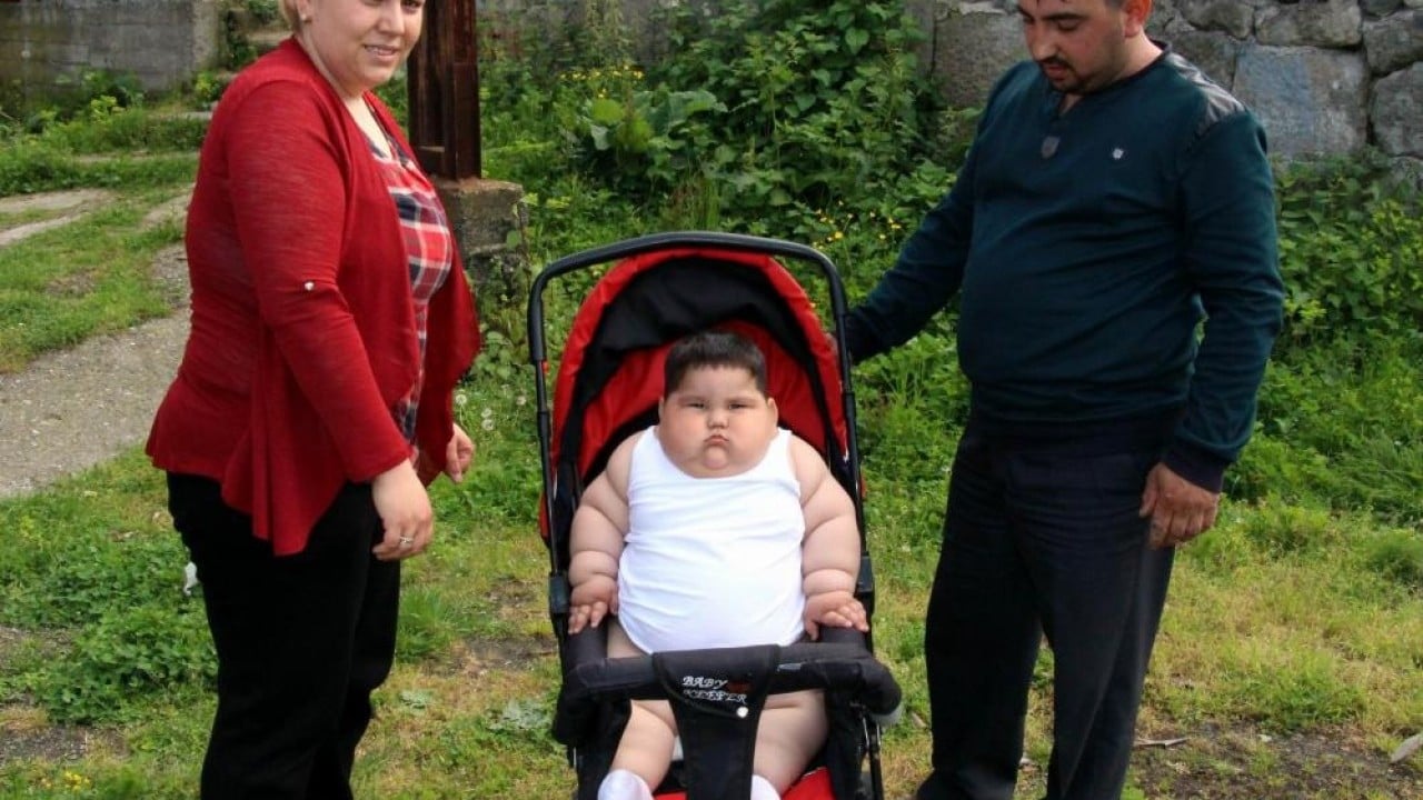 Foto - Yağız'ın inanılmaz değişimi 5 yaşında 90 kiloy, 11 yaşında 40 kilo