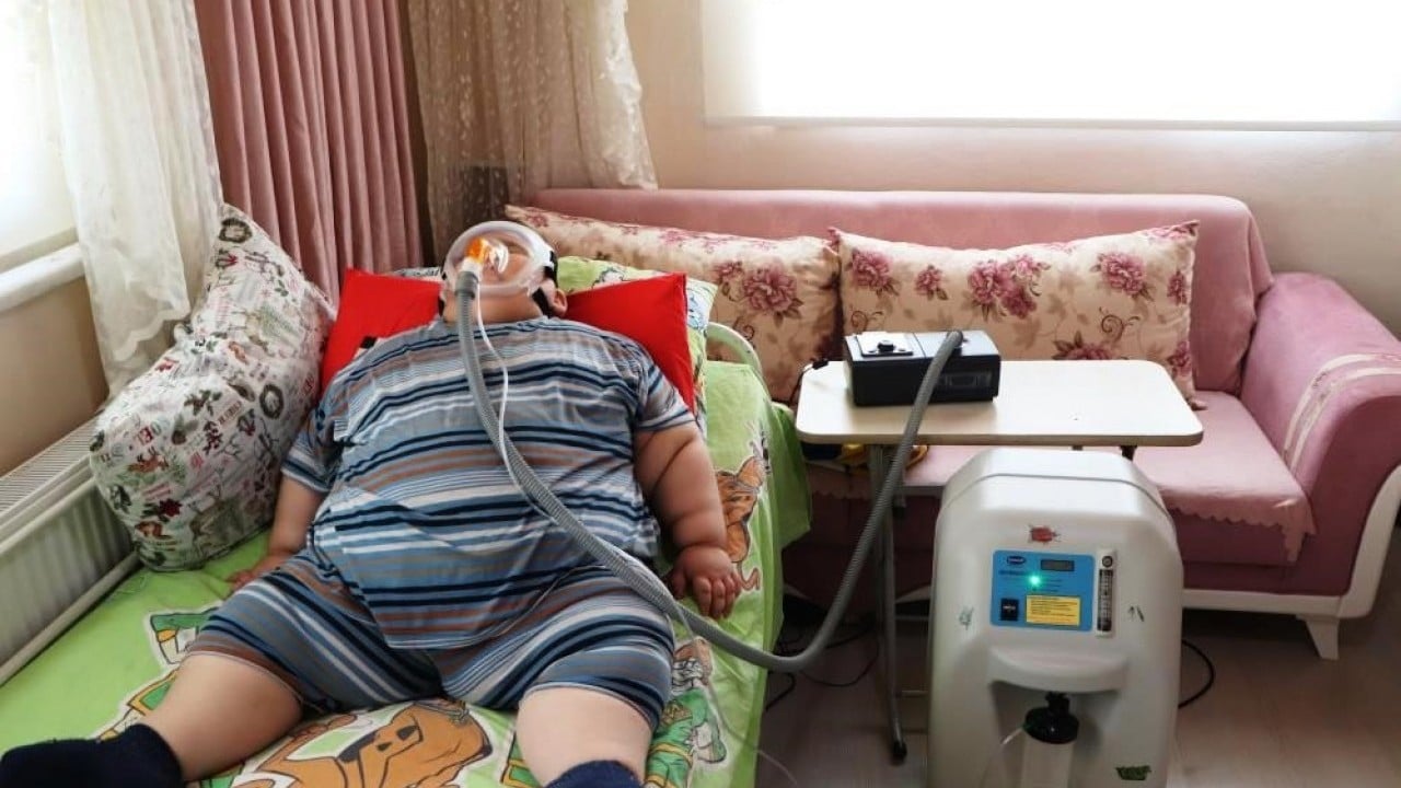 Foto - Yağız'ın inanılmaz değişimi 5 yaşında 90 kiloy, 11 yaşında 40 kilo