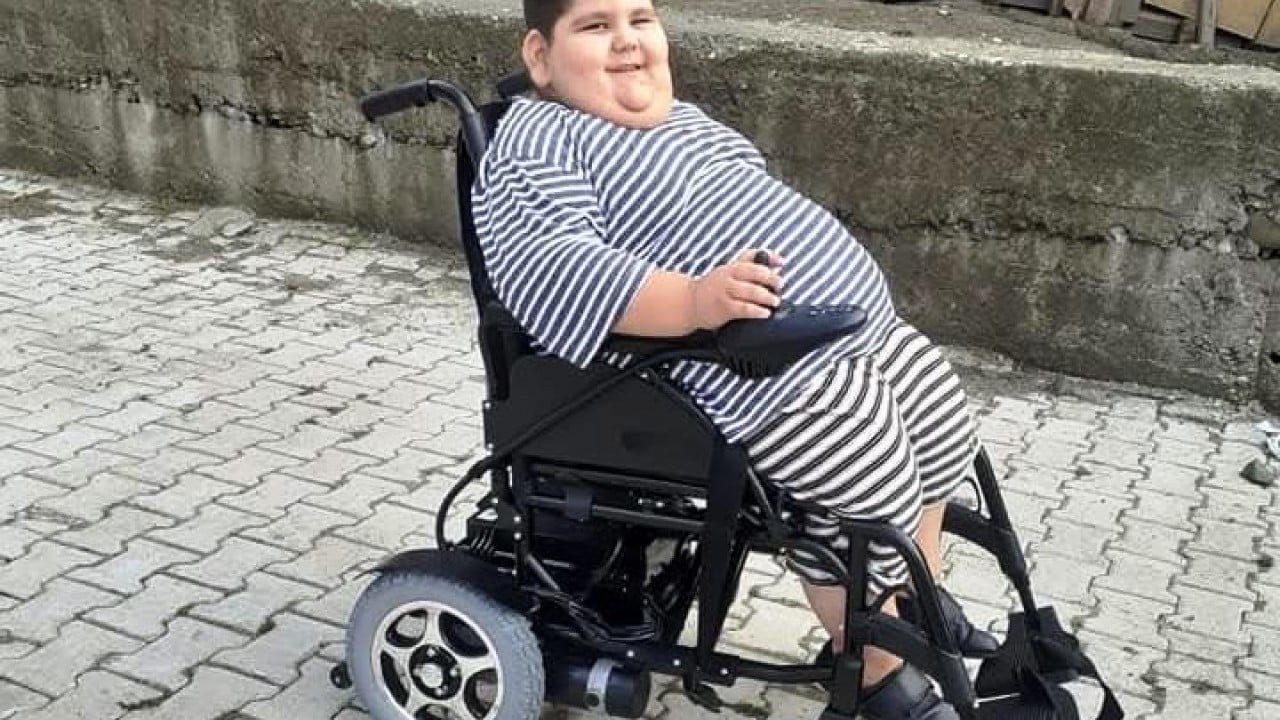 Foto - Yağız'ın inanılmaz değişimi 5 yaşında 90 kiloy, 11 yaşında 40 kilo
