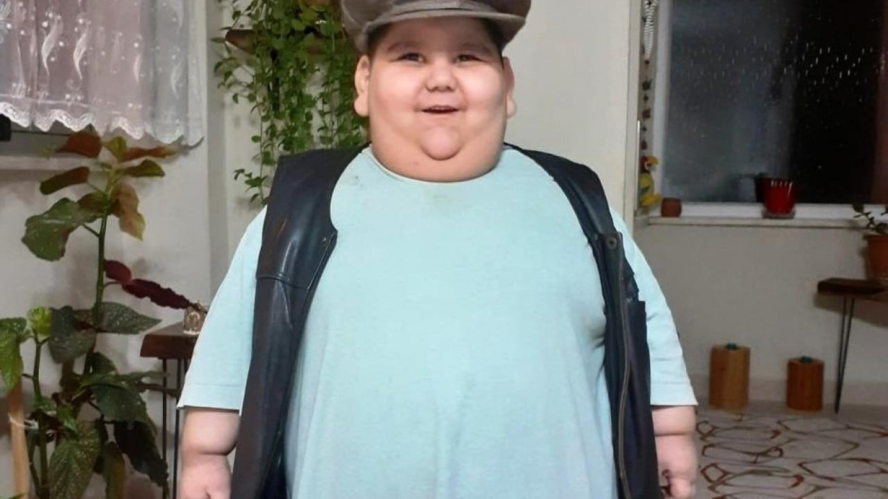 Foto - Yağız'ın inanılmaz değişimi 5 yaşında 90 kiloy, 11 yaşında 40 kilo