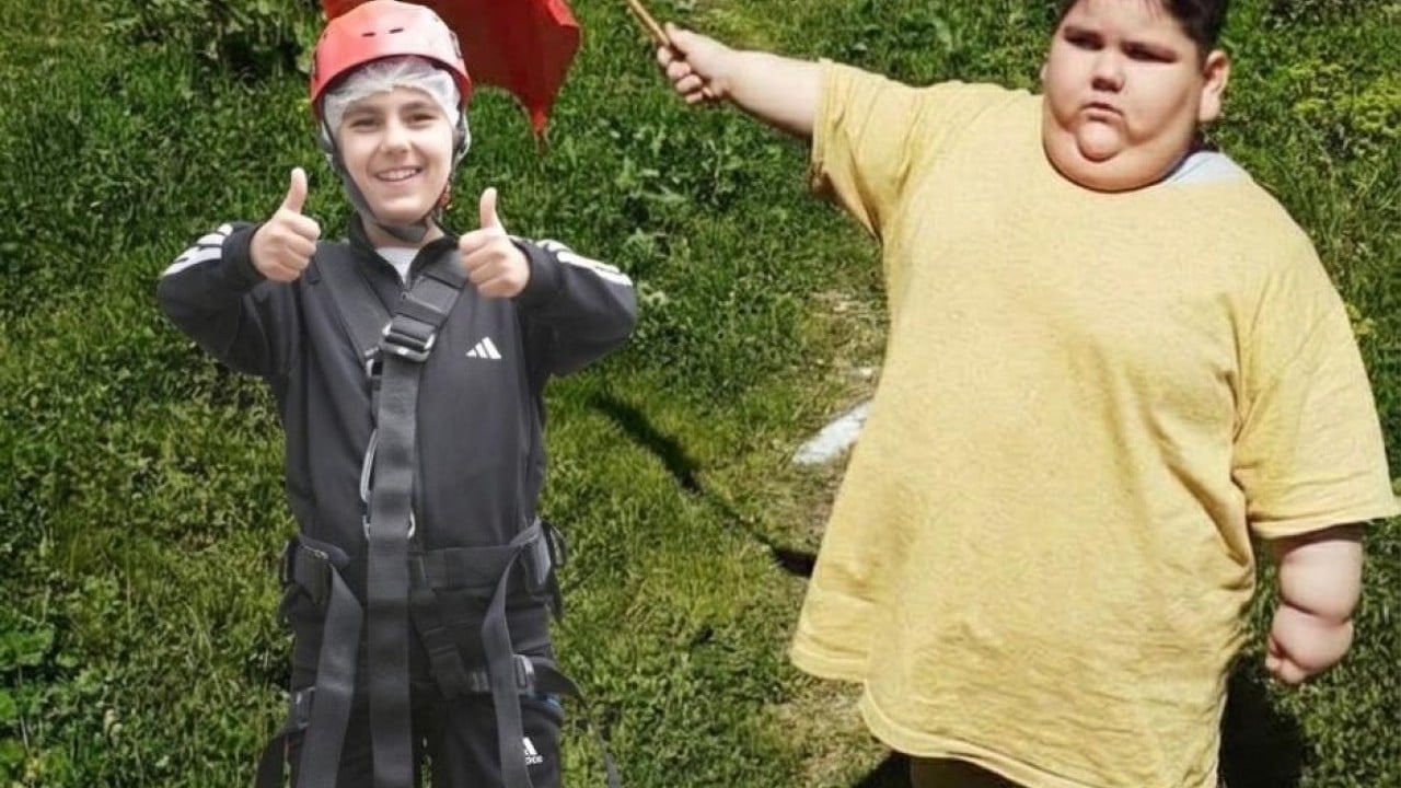 Yağız'ın inanılmaz değişimi 5 yaşında 90 kiloy, 11 yaşında 40 kilo