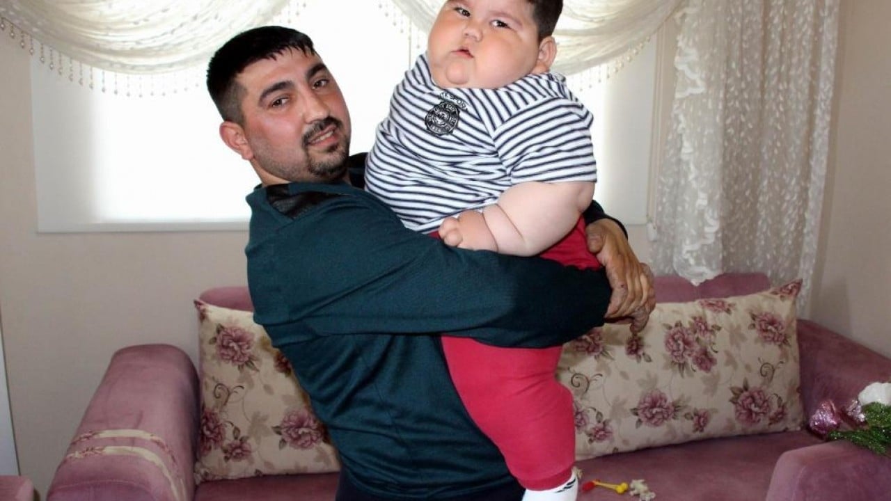 Foto - Yağız'ın inanılmaz değişimi 5 yaşında 90 kiloy, 11 yaşında 40 kilo