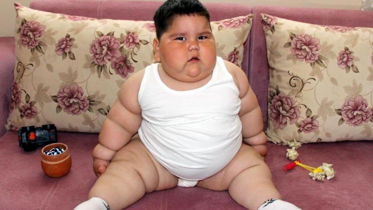 Foto - Yağız'ın inanılmaz değişimi 5 yaşında 90 kiloy, 11 yaşında 40 kilo