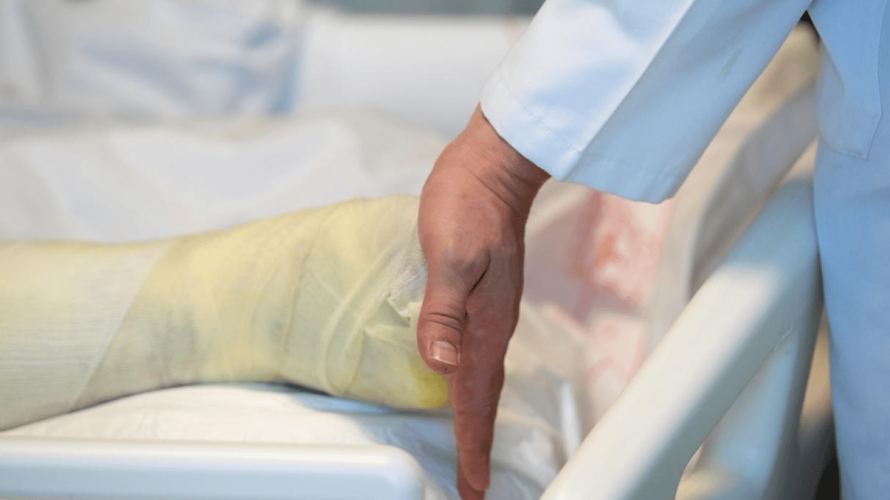 Yanık tedavisinde yeni dönem: Hedef ilk müdahalede hatasız uygulama