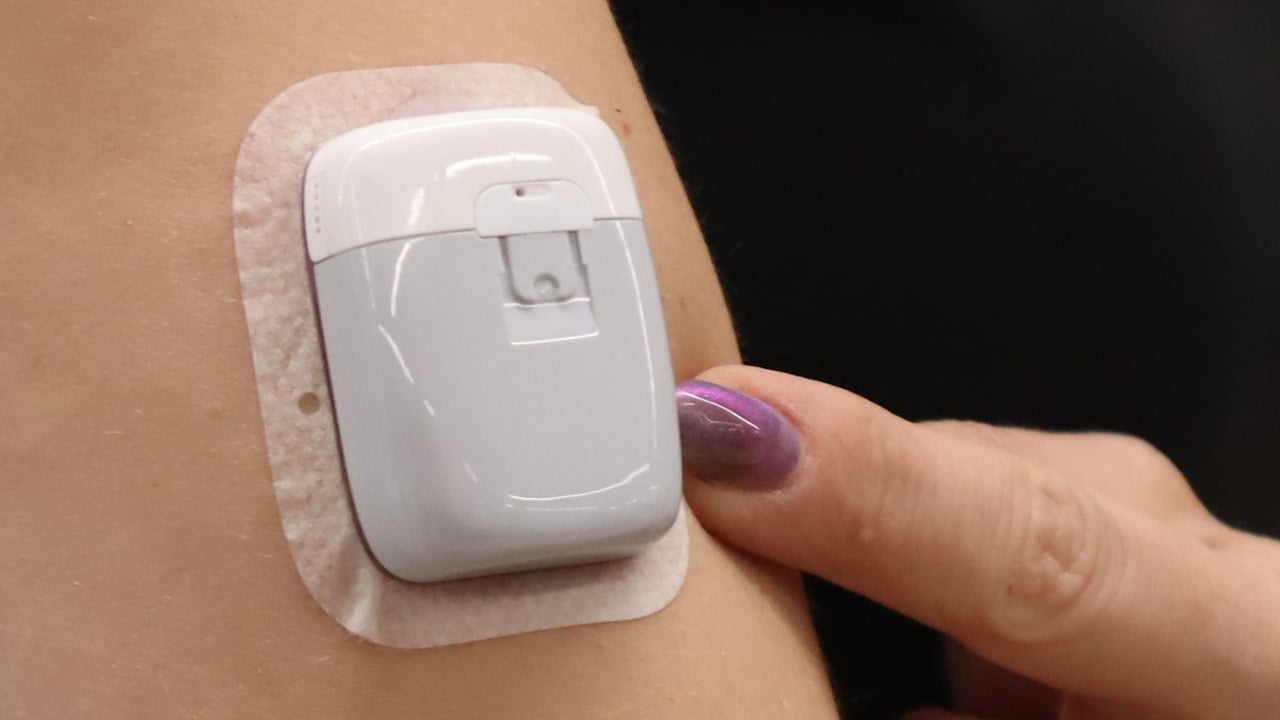 Foto - Yapay zeka destekli teknoloji: Diyabet tedavisinde ‘Yapay pankreas’ devrimi