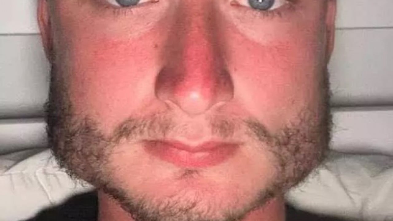 Foto - Yüzüne bakan inanamıyor: Yaptığı spor yüz şeklini değiştirdi!