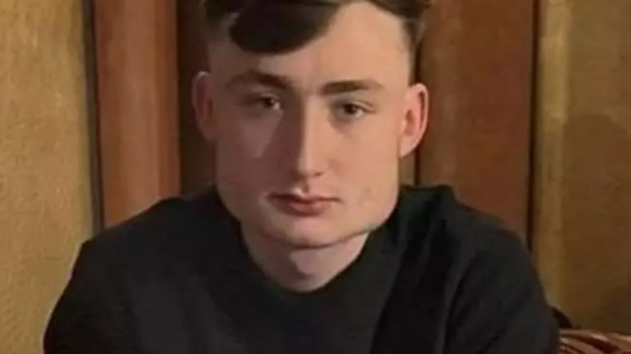 Foto - Yüzüne bakan inanamıyor: Yaptığı spor yüz şeklini değiştirdi!