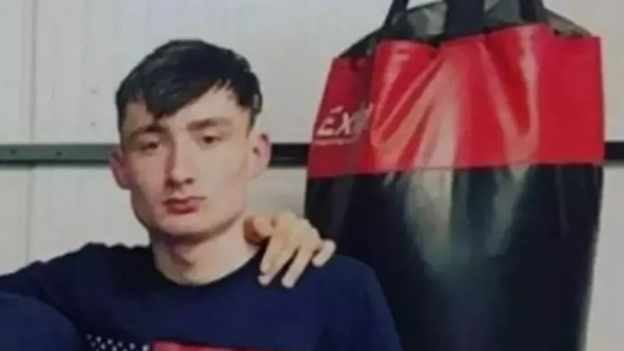 Foto - Yüzüne bakan inanamıyor: Yaptığı spor yüz şeklini değiştirdi!