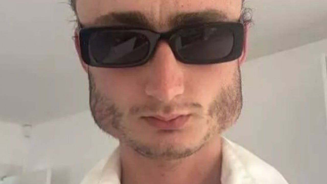 Foto - Yüzüne bakan inanamıyor: Yaptığı spor yüz şeklini değiştirdi!