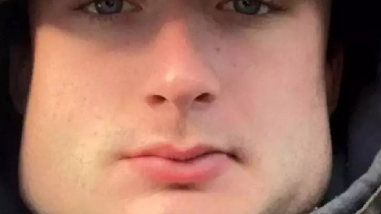 Foto - Yüzüne bakan inanamıyor: Yaptığı spor yüz şeklini değiştirdi!