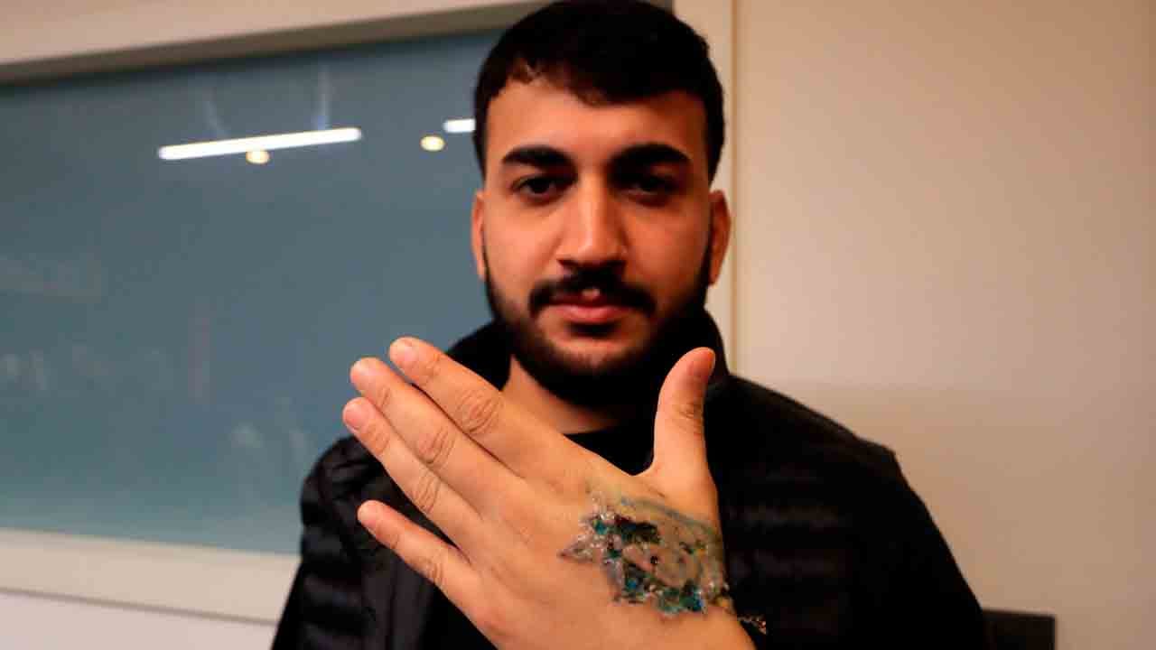 Yaptırmadan önce bir kez daha düşünün: İşte dövme hastalığının kötü sonu